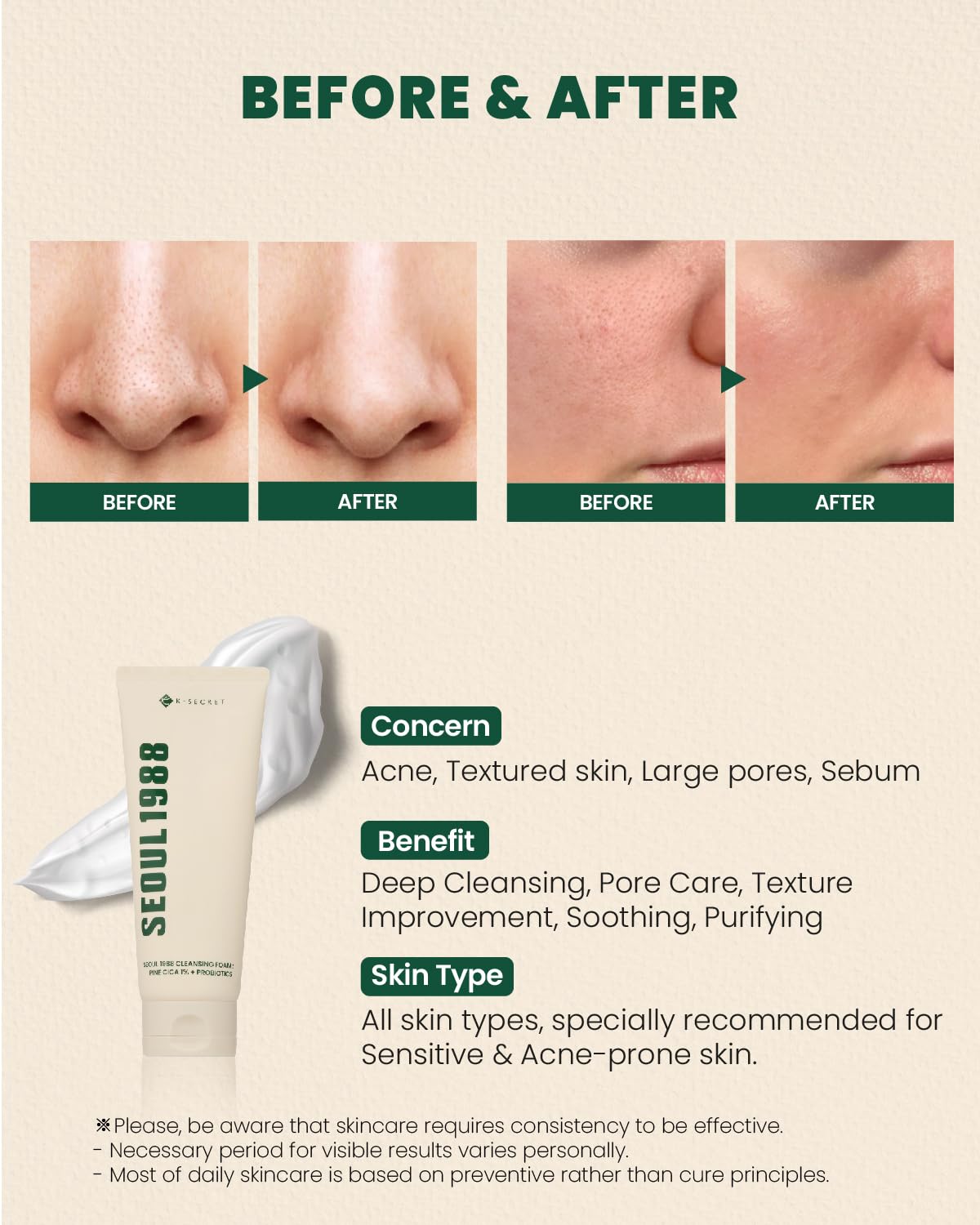 KSECRET SEOUL 1988 Cleansing Foam  Pine Cica 1% + Probiotics [150ml]